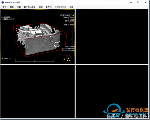 LEADTOOLS醫學三維影像演示使用入門-5305