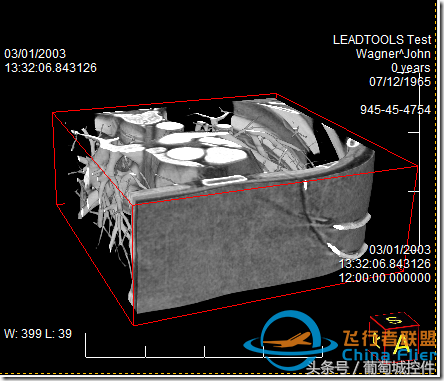LEADTOOLS醫學三維影像演示使用入門-9262