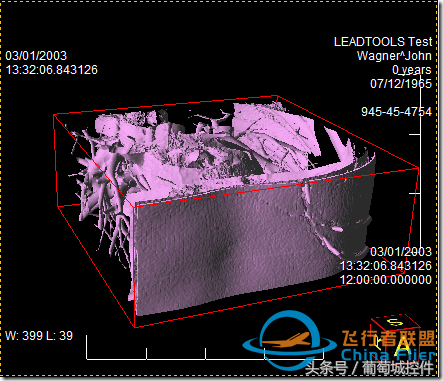 LEADTOOLS醫學三維影像演示使用入門-8968