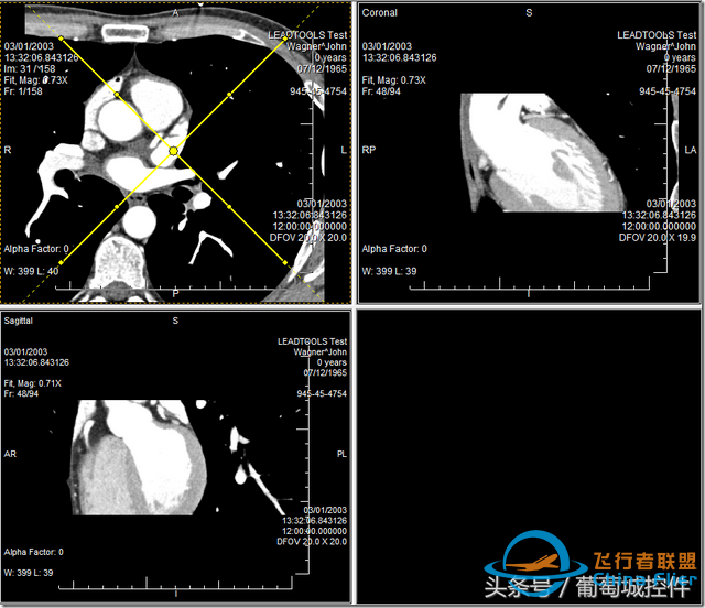 LEADTOOLS醫學三維影像演示使用入門-227
