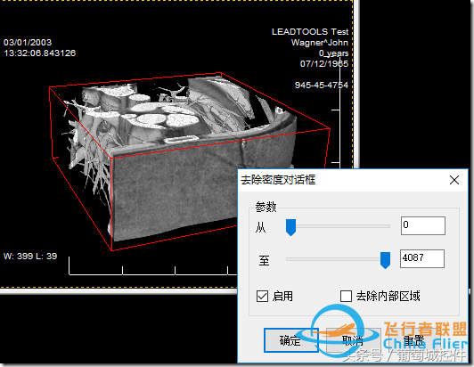 LEADTOOLS醫學三維影像演示使用入門-3777